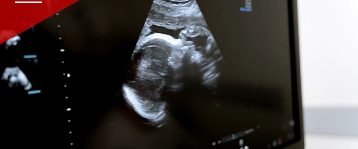 Ninth Circuit Pauses Idaho Judge's Ruling Expanding Abortion Exceptions Beyond State Law