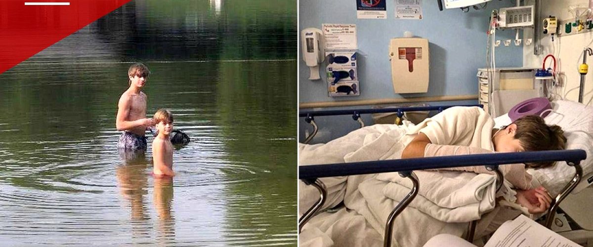 Rabid Beaver Attack at Maryland State Park Leaves Teen Hospitalized, Family Says