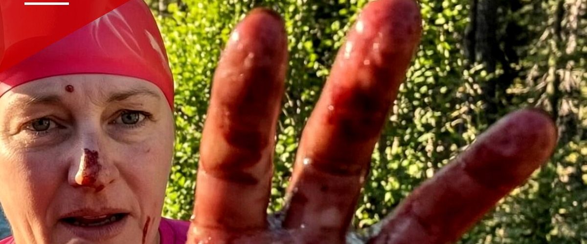 Reno Swim Instructor Needs 38 Stitches After River Otter Attack at Lake Tahoe